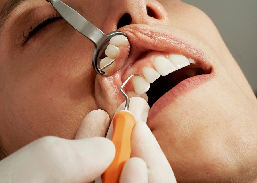 Endodontia — Tratamento de Canal na Dra Adriana Britto Odontologia