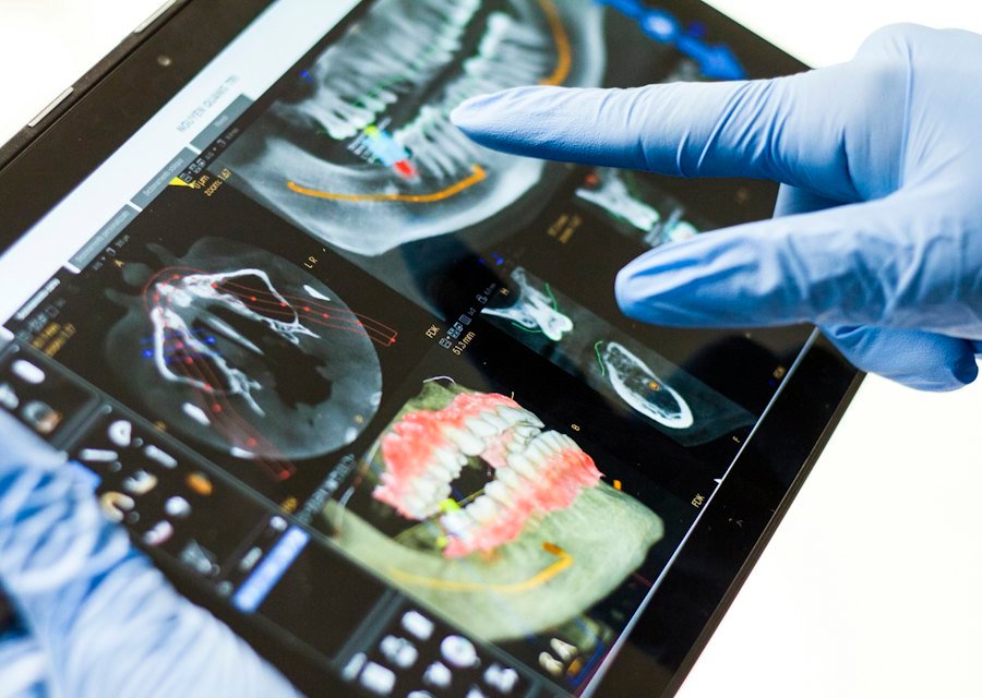 Implantes Dentários na Dra Adriana Britto Odontologia